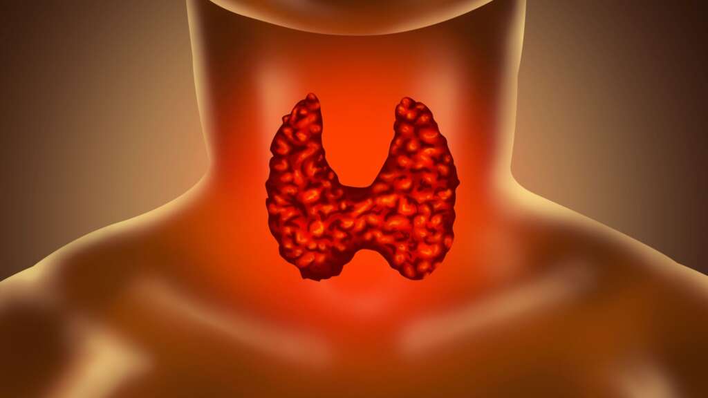 Hypothyroidism – Symptoms, Diagnosis and Treatment