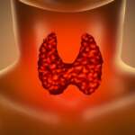 Hypothyroidism – Symptoms, Diagnosis and Treatment