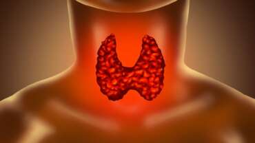 Hypothyroidism – Symptoms, Diagnosis and Treatment
