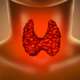 3d illustration of hypothyroidism, a common, highly treatable condition where an underactive thyroid gland fails to produce enough hormones to meet the body's needs, slowing metabolism