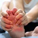 Gout – Causes, Risks, Diagnosis & Treatment