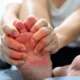 Man on bed with pillow embrace foot with painful swollen gout inflammation