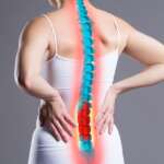 Understanding Osteoporosis – Symptoms, Diagnosis and Treatment