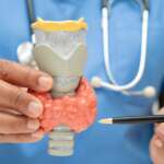 Hyperthyroidism – Overactive Thyroid Gland