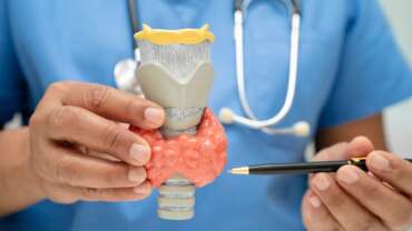 Hyperthyroidism – Overactive Thyroid Gland
