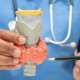 Detailed examination of the overactive thyroid gland model by a medical professional