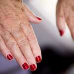 Understanding Lupus – Causes, Symptoms, and Treatment Options