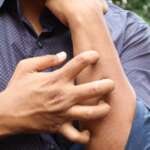Drug Allergies & Penicillin Exposed – Symptoms, Causes, Diagnosis & Treatment