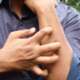 Skin allergy reaction test on arm due to drug allergy