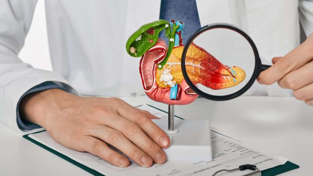 Pancreatic Cancer – Types, Risks, Symptoms, Diagnosis, Treatment & Complications