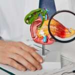 Pancreatic Cancer – Types, Risks, Symptoms, Diagnosis, Treatment & Complications