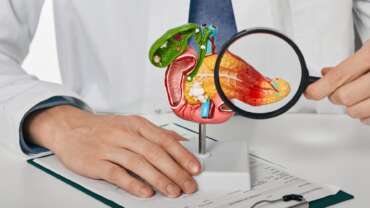 Complications of Pancreatic Cancer – Types, Risks, Symptoms, Diagnosis & Treatment