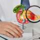 Doctor using a pancreas anatomy model to explain the complications of pancreatic cancer
