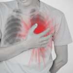 Rheumatic Heart Disease – Risks, Signs, Diagnosis, and Empowered Solutions