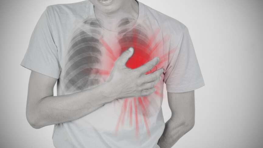 Rheumatic Heart Disease