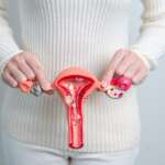The Essential Guide to Ovarian Cancer