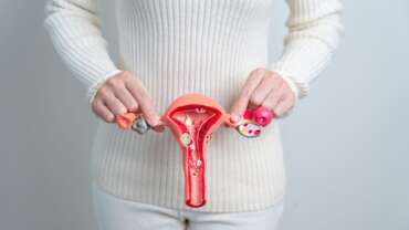 The Essential Guide to Ovarian Cancer