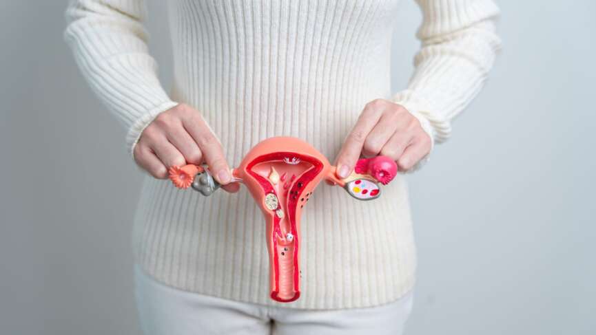 A girl holding a 3D anatomy model of vagina representing ovarian cancer