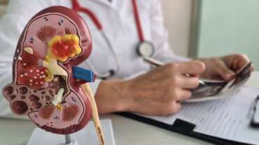 Unlocking the Power of Dialysis: Types, Benefits, and Your Healthcare Journey