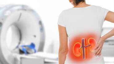 Chronic Kidney Disease (CKD) – Symptoms, Diagnosis and Prevention