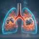 medical illustraion representing Chronic Obstructive Pulmonary Disease (COPD) is a progressive, irreversible lung disease causing chronic breathing difficulties, primarily caused by smoking