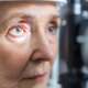 Senior female patient during an eye exam before modern cataract surgery, showing cataract clouding that causes blurry vision, light sensitivity and poor night vision
