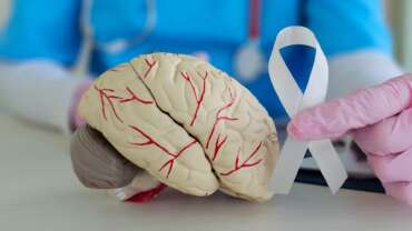 Guillain-Barré Syndrome (GBS) – Causes, Symptoms, Diagnosis and Treatment