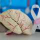 A medical professional in scrubs showcases a brain model alongside a white ribbon concept representing Guillain-Barré syndrome