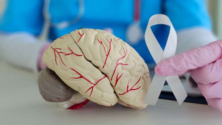 Guillain-Barré Syndrome