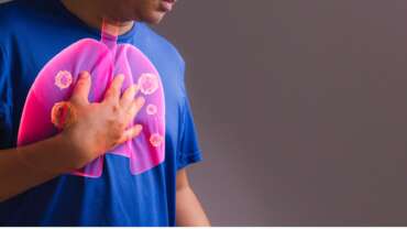 Pulmonary Hypertension – Causes, Symptoms, Risks & Life-Saving Treatments Explained