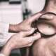 A doctor with a magnifying glass examining the skin tag of a patient with melanoma, which is the most dangerous form of skin cancer, developing from pigment-producing cells (melanocytes) due to UV damage from sun exposure or tanning beds
