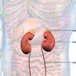 Addison’s Disease – Key Symptoms, and Proven Treatment Strategies