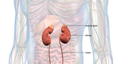 Addison’s Disease – Key Symptoms, and Proven Treatment Strategies