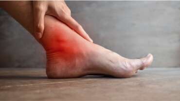Reactive Arthritis – Symptoms, Diagnosis, Treatment, and Prevention