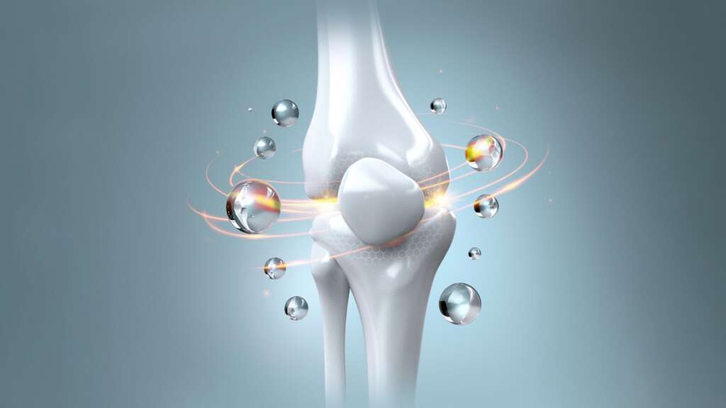 Osteoarthritis – Symptoms, Causes, Diagnosis, and Treatment