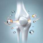 Osteoarthritis – Symptoms, Causes, Diagnosis, and Treatment