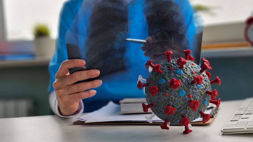 Acute Respiratory Distress Syndrome -Symptoms, Diagnosis, Treatment and Recovery