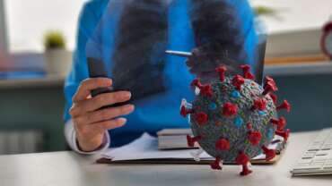 Acute Respiratory Distress Syndrome -Symptoms, Diagnosis, Treatment and Recovery