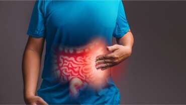Crohn’s Disease – Symptoms, Causes, Diagnosis and Treatment