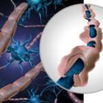 Unraveling MS – Symptoms, Treatment, and Surprising Types