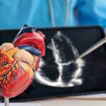 Doctors' pen-point model of the heart along with atrial fibrillation risk