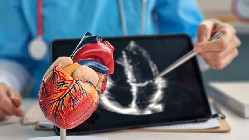 Doctors' pen-point model of the heart along with atrial fibrillation risk