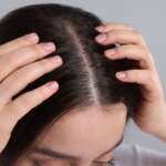 A young woman with no dandruff on her scalp, representing the treatment of dandruff