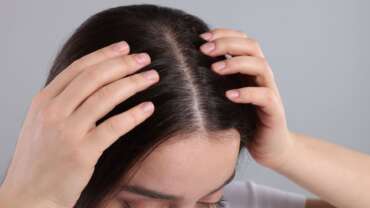 A young woman with no dandruff on her scalp, representing the treatment of dandruff