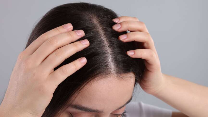 A young woman with no dandruff on her scalp, representing the treatment of dandruff