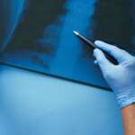 A Male doctor examines an x-ray of lungs in hospital and how asthma is affecting them