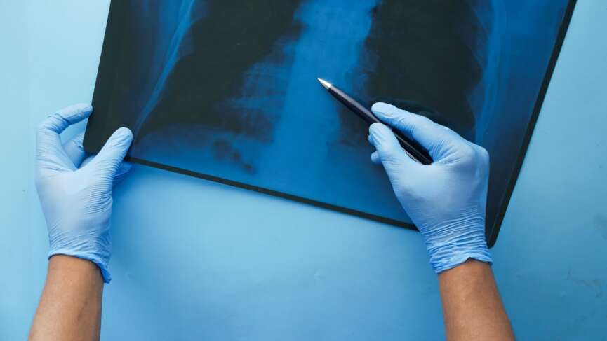 how asthma affects lungs