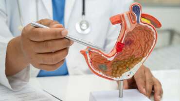 doctor holding anatomy model for study, diagnosis, and treatment in a hospital representing stomach ulcer symptoms
