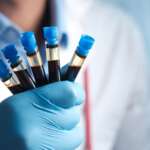 a gloved hand is holding five test tubes containing blood samples in a laboratory for blood cancer risk factors