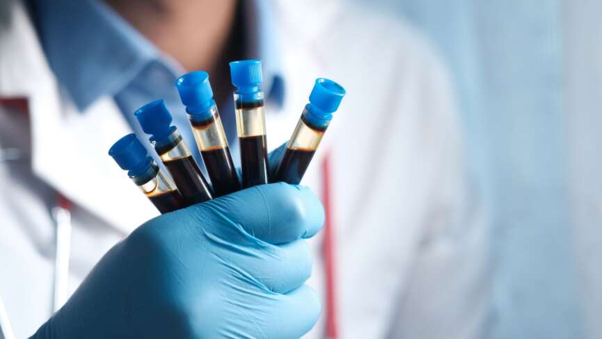a gloved hand is holding five test tubes containing blood samples in a laboratory for blood cancer risk factors